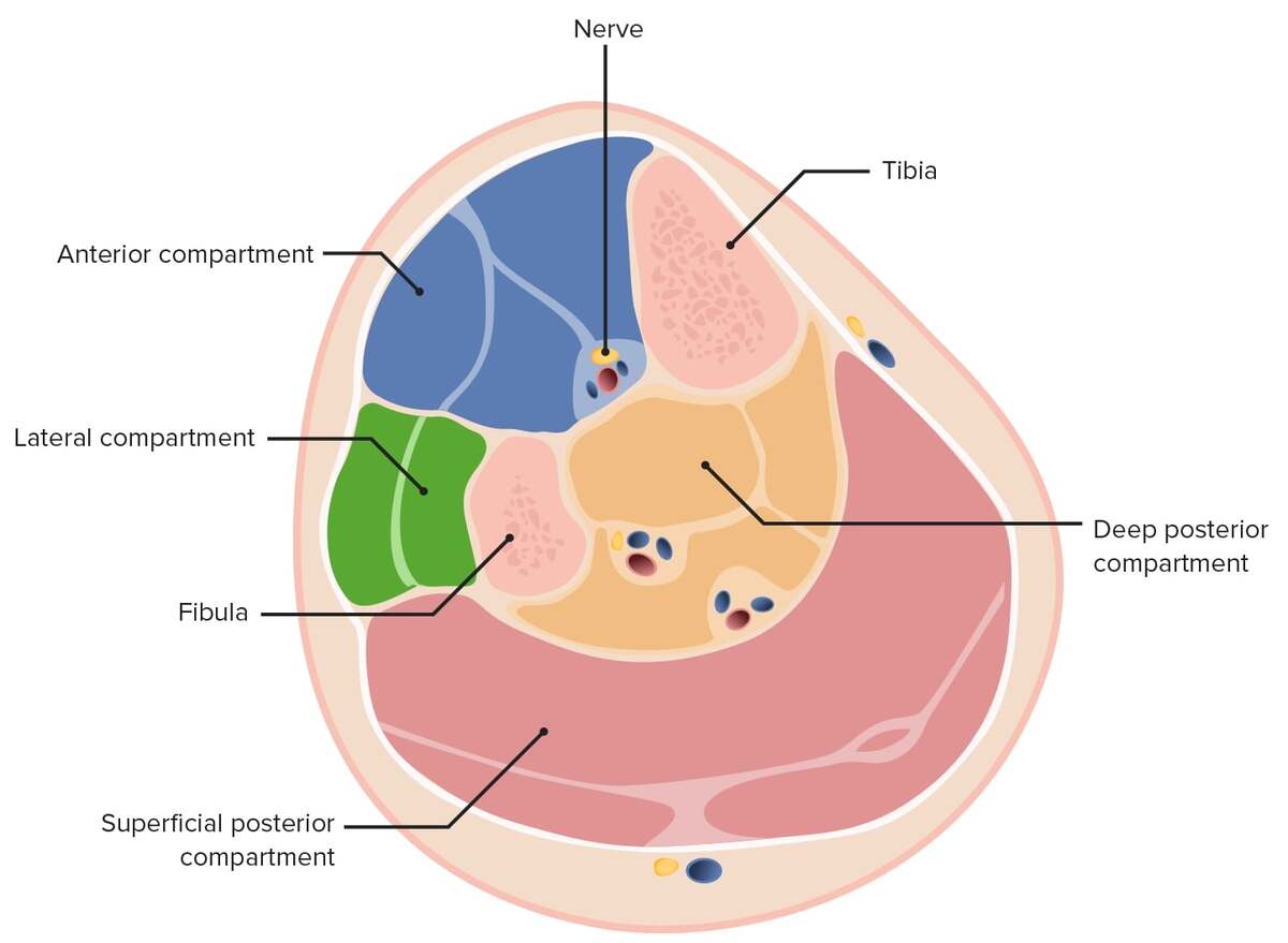 Compartment syndrome – a complex and insidious medical problem