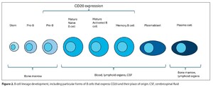 Figure from article: Anti-CD20 treatment in...