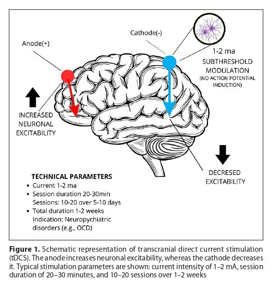 Figure from article: Transcranial direct current...