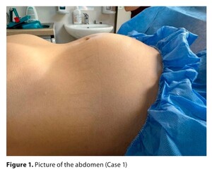 Figure from article: Unusual presentations of...