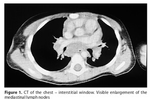 Figure from article: The battle for life – an...